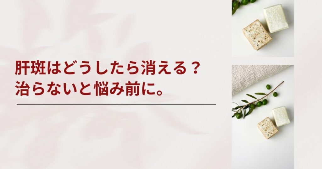 肝斑はどうしたら消える？一生治らないと諦める前に知りたい知識を解説