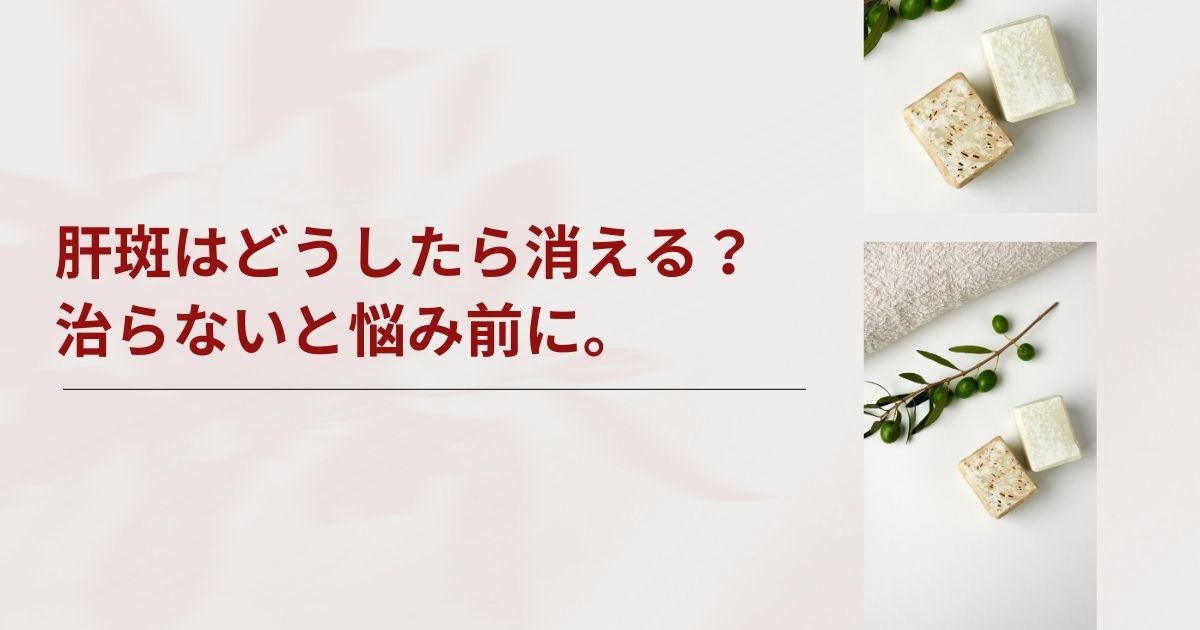 肝斑はどうしたら消える？一生治らないと諦める前に知りたい知識を解説
