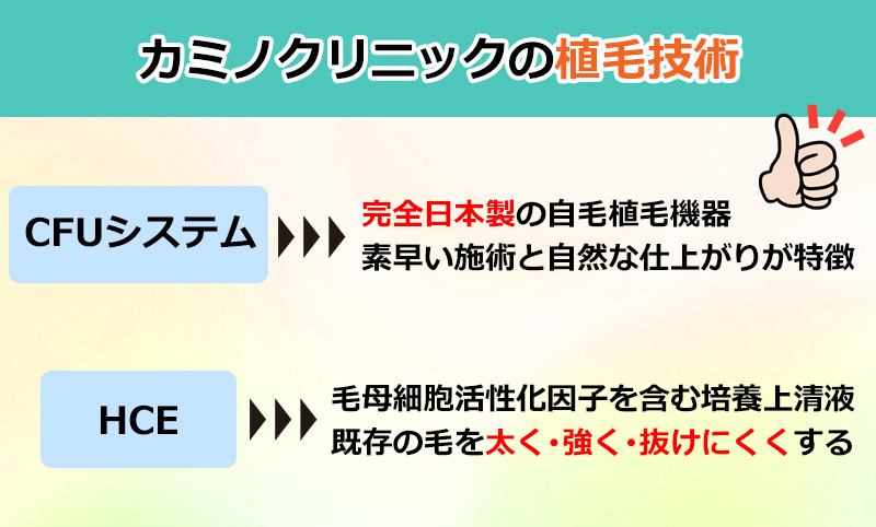 カミノクリニックの植毛技術のオリジナル図解
