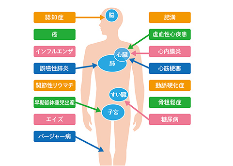 歯周病菌と関連がある代表的な全身疾患やリスク