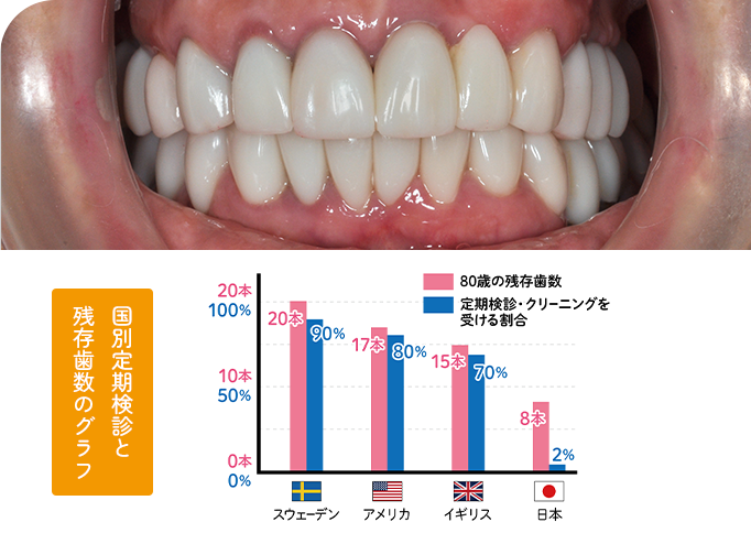 予防歯科